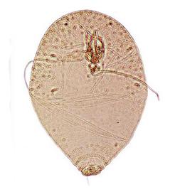  
	 Sclerosococcus ferrisi   
